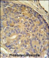 BORCS5 Antibody (C-term)